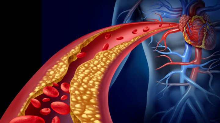 Alimente care curăță vasele de sânge de colesterol și reduc riscul de infarct